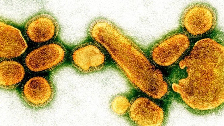 Вот так выглядел вирус испанского гриппа, в 1918 году унесшего жизни от 50 до 100 млн человек (по разным оценкам). Фото: SCIENCE PHOTO LIBRARY