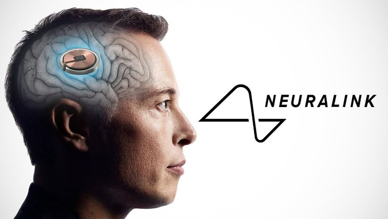 Компании Илона Маска разрешили чипировать человеческий мозг. Фото: YouTube