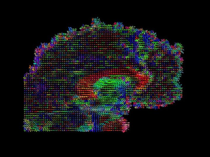 Сагиттальный срез данных диффузионной тензорной томографии, каждый пиксель представлен эллипсоидным глифом, отображающим диффузию молекул воды. Альтернатива: HARDI (диффузионная томография высокого углового разрешения), сагиттальный вид. Тензор можно визуализировать как эллипсоид в 3D-пространстве, показывающий отображения жидкости и связи мозга Сагиттальный срез данных диффузионной тензорной томографии, каждый пиксель представлен эллипсоидным глифом, отображающим диффузию молекул воды. Альтернатива: HARDI (диффузионная томография высокого углового разрешения), сагиттальный вид. Тензор можно визуализировать как эллипсоид в 3D-пространстве, показывающий отображения жидкости и связи мозга